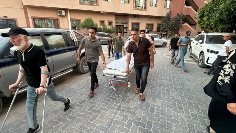 الصحة: 3 شهداء و21 إصابة وصلوا مشافي غزة خلال 24 ساعة